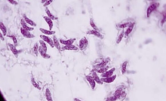 Protozoesche Parasit Toxoplasma gondii de verursaache Agent vun Toxoplasmose