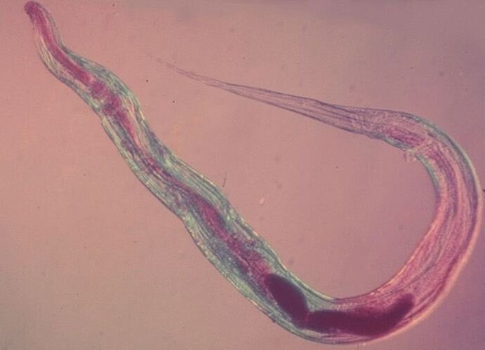 Pinworm ënner dem Mikroskop